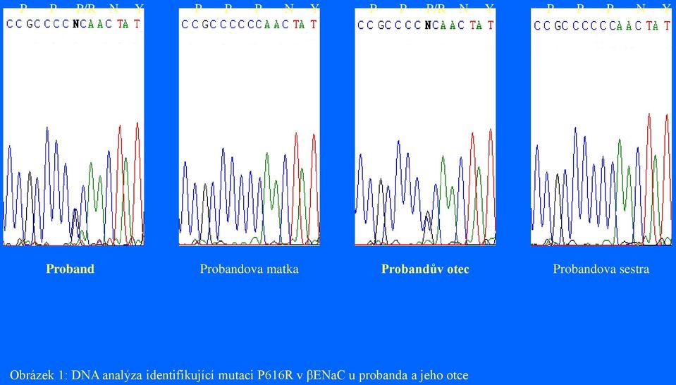 Probandova sestra Obrázek 1: DNA analýza