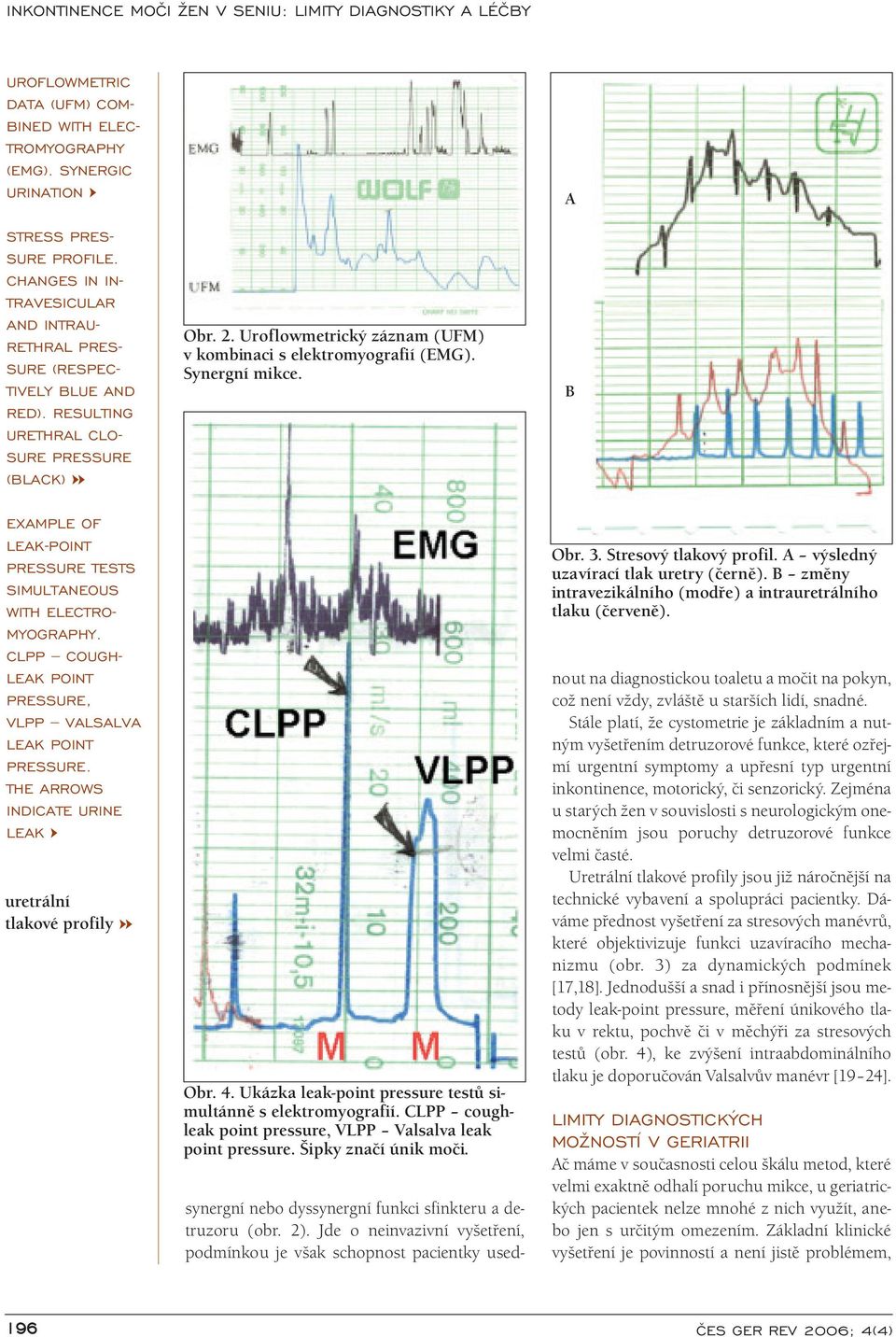 A B EXAMPLE OF LEAK POINT PRESSURE TESTS SIMULTANEOUS WITH ELECTRO MYOGRAPHY. CLPP COUGH LEAK POINT PRESSURE, VLPP VALSALVA LEAK POINT PRESSURE.