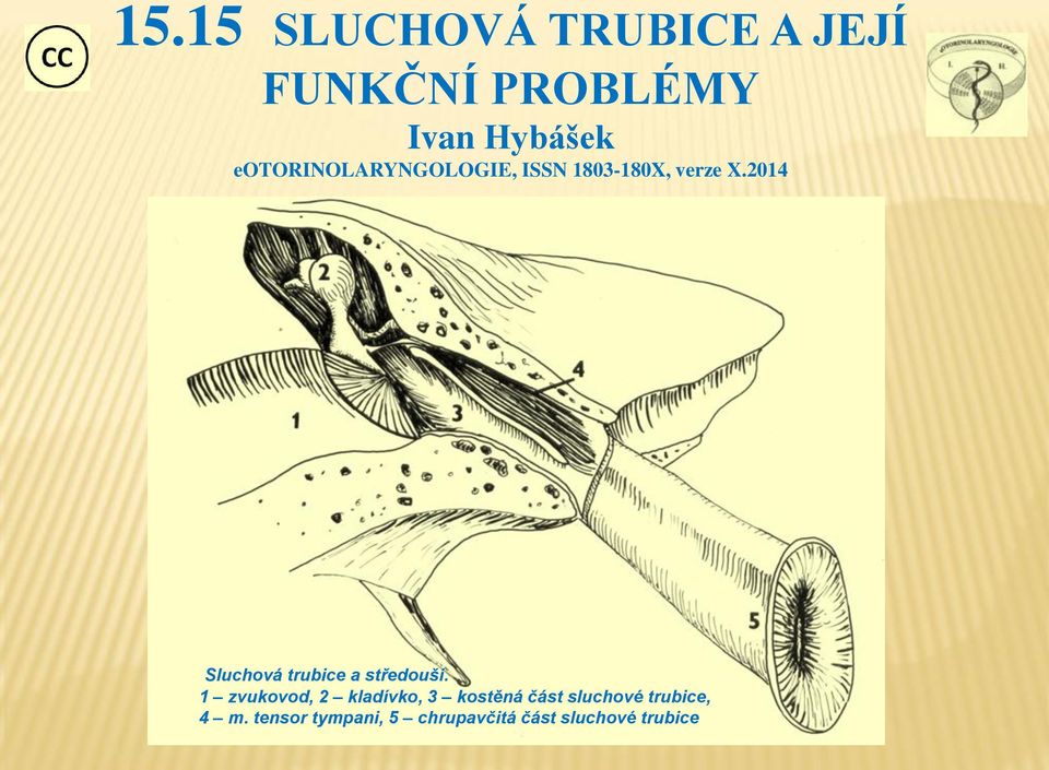 15.15 SLUCHOVÁ TRUBICE A JEJÍ FUNKČNÍ PROBLÉMY Ivan Hybášek  eotorinolaryngologie, ISSN X, verze X PDF Free Download