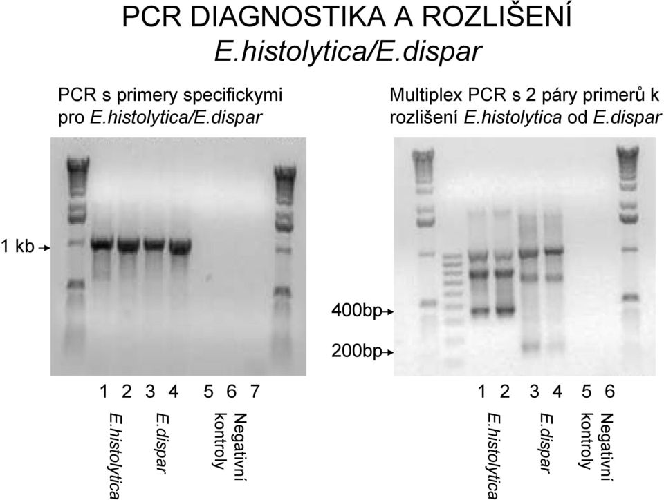 dispar Multiplex PCR s 2 páry primerů k rozlišení E.histolytica od E.