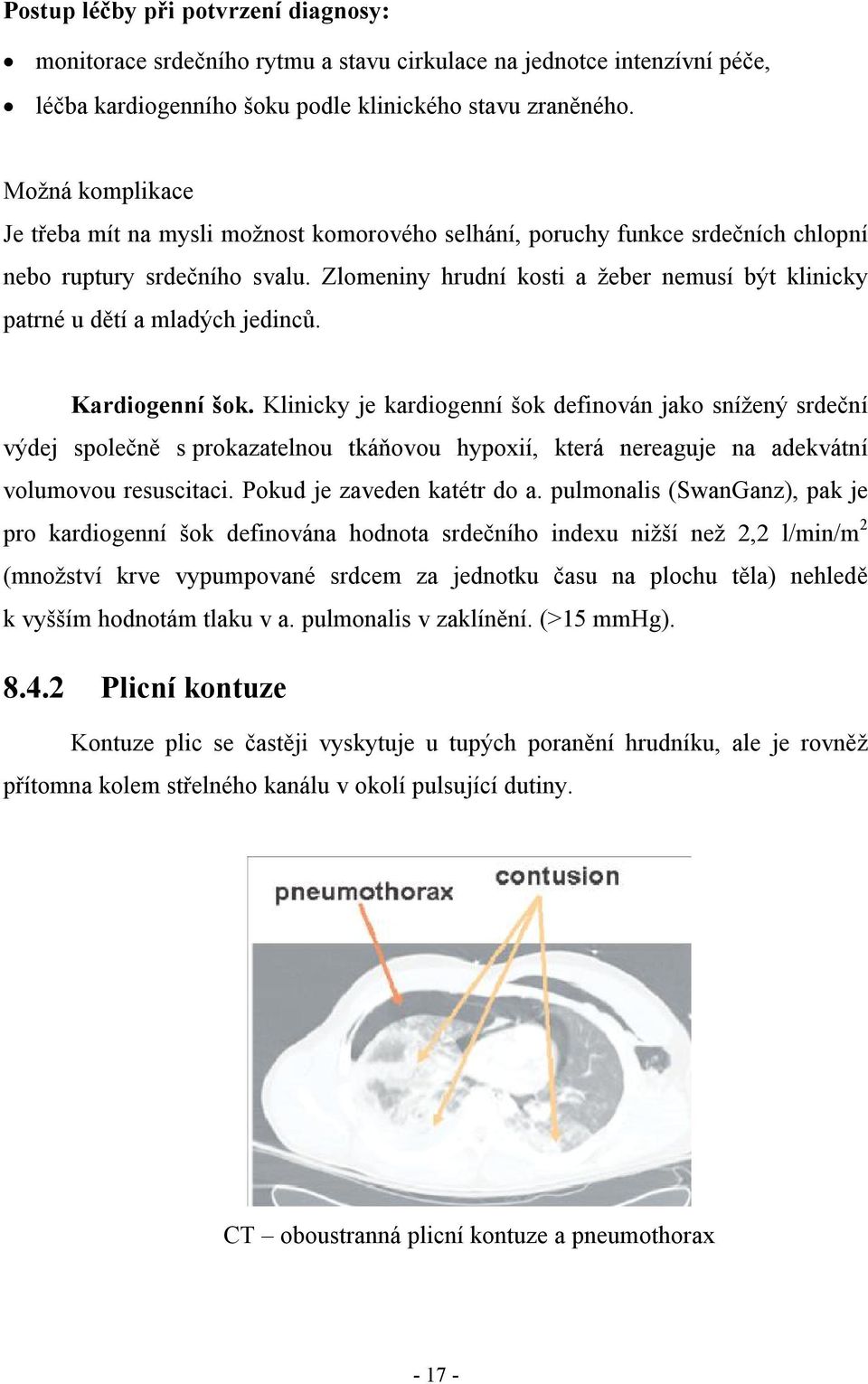 Zlomeniny hrudní kosti a žeber nemusí být klinicky patrné u dětí a mladých jedinců. Kardiogenní šok.