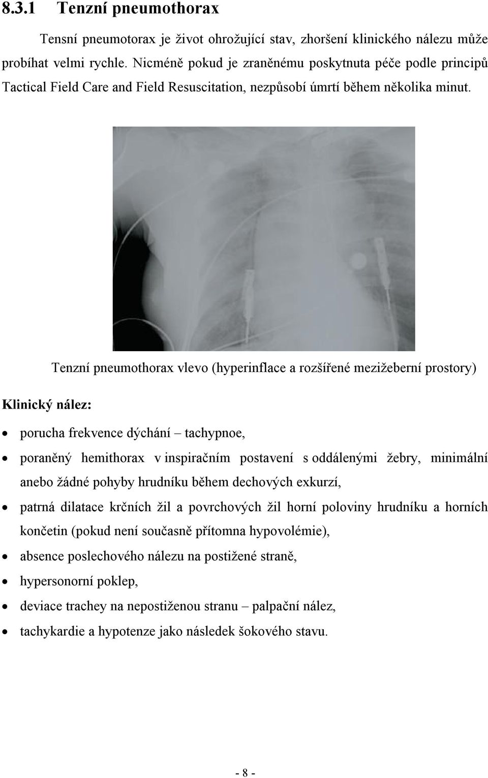 Tenzní pneumothorax vlevo (hyperinflace a rozšířené mezižeberní prostory) Klinický nález: porucha frekvence dýchání tachypnoe, poraněný hemithorax v inspiračním postavení s oddálenými žebry,