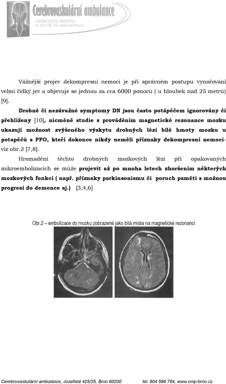 bílé hmoty mozku u potapěčů s PFO, kteří dokonce nikdy neměli příznaky dekompresní nemociviz obr.2 [7,8].