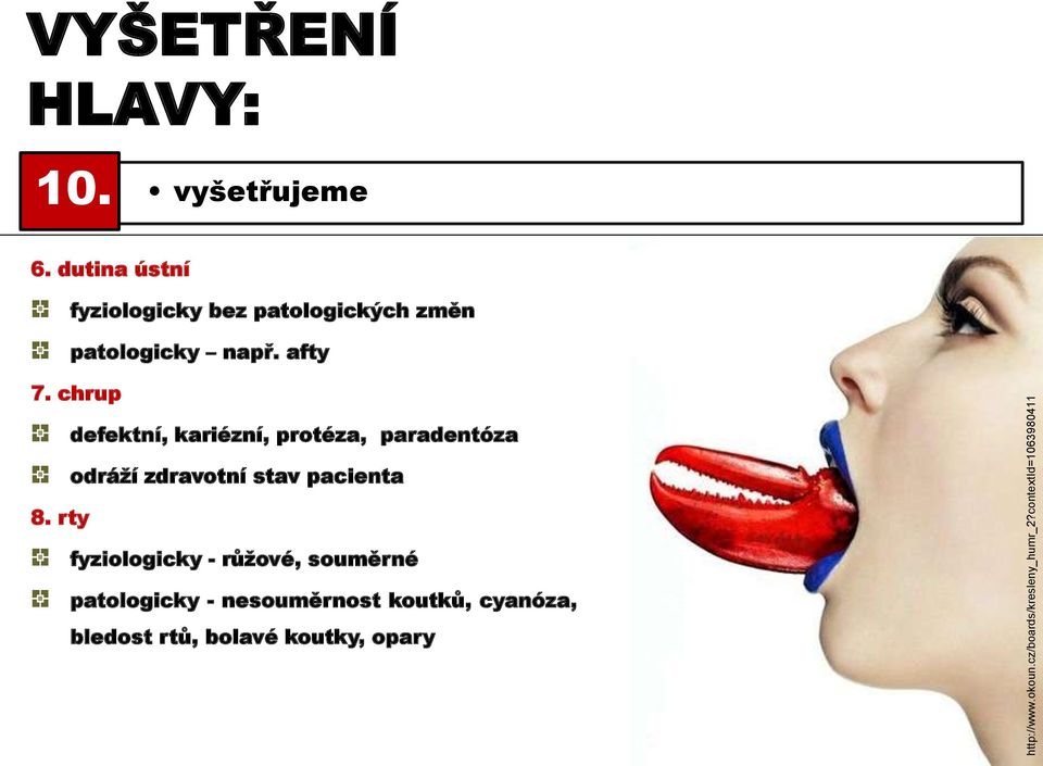 chrup defektní, kariézní, protéza, paradentóza odráží zdravotní stav pacienta 8.