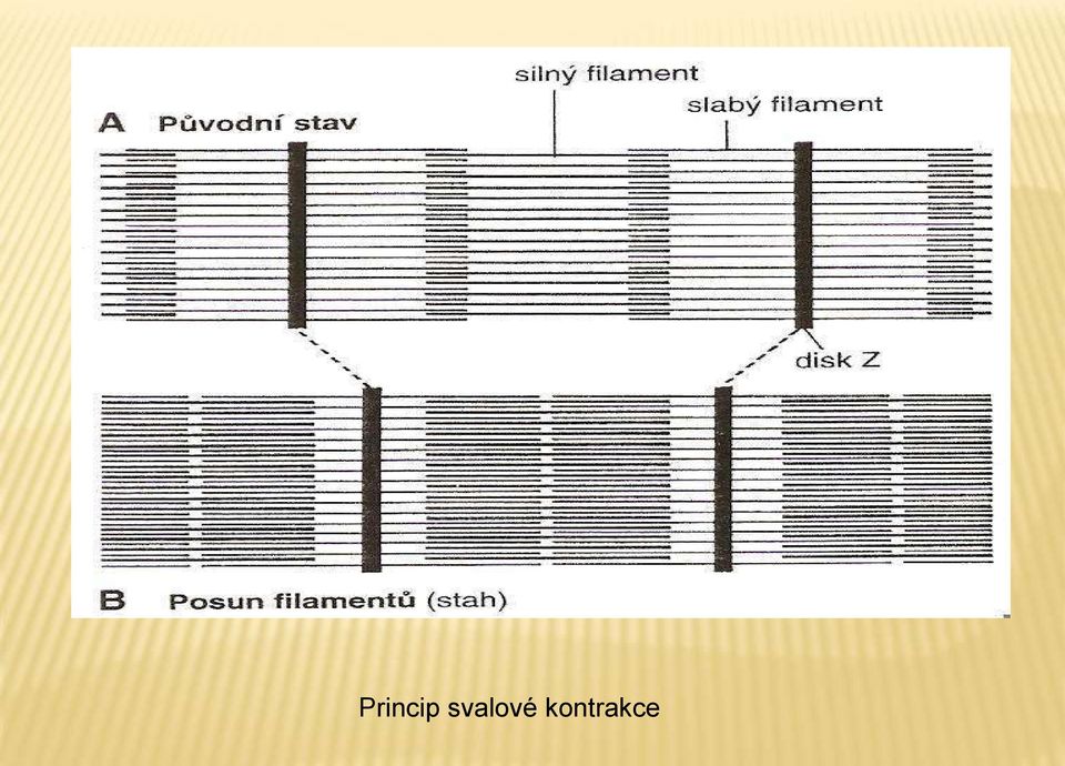 kontrakce