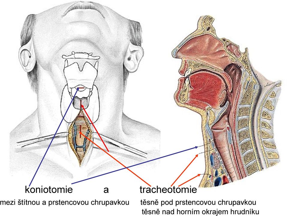 Horní cesty dýchací cavitas nasi, pars nasalis pharyngis (nosohltan) Dolní  cesty dýchací larynx, trachea, bronchi, pulmones - PDF Stažení zdarma