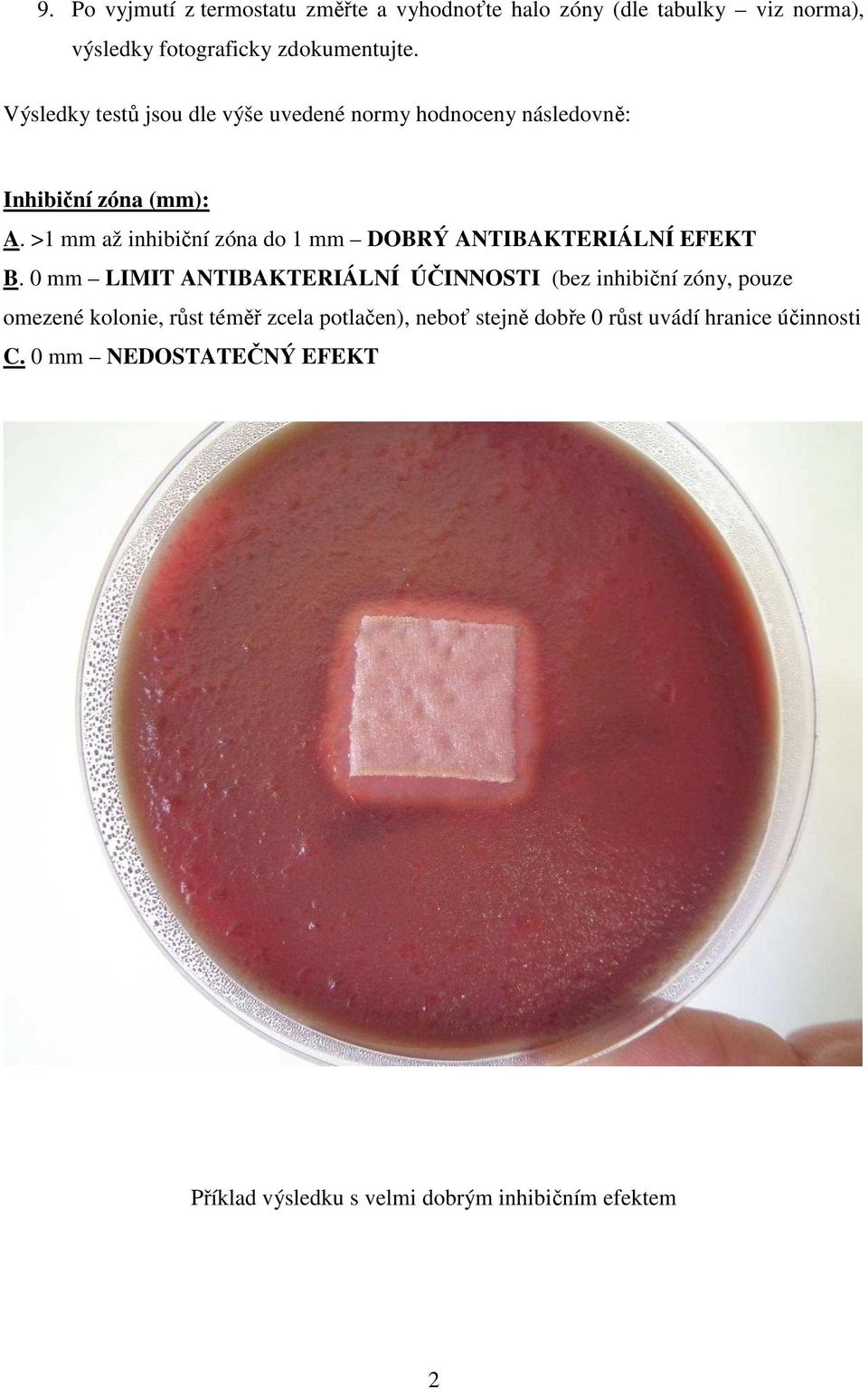 >1 mm až inhibiční zóna do 1 mm DOBRÝ ANTIBAKTERIÁLNÍ EFEKT B.