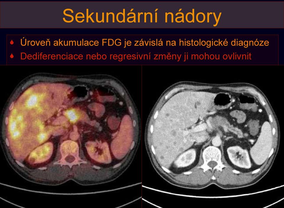 histologické diagnóze