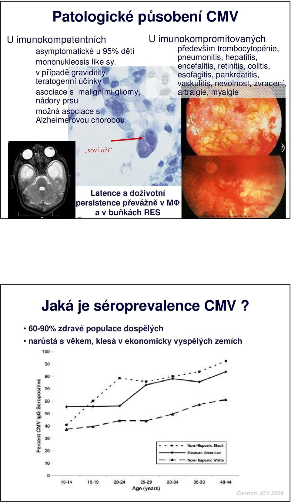 pneumonitis, hepatitis, encefalitis, retinitis, colitis, esofagitis, pankreatitis, vaskulitis, nevolnost, zvracení, artralgie, myalgie soví oči www.akh-wien.ac.at/iol/ misc/mainpage.