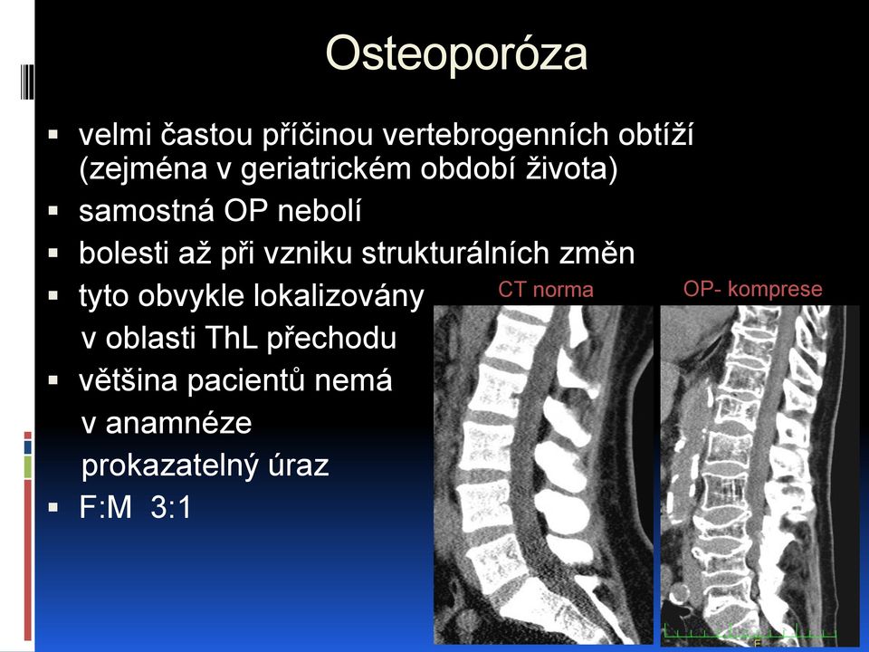 strukturálních změn tyto obvykle lokalizovány CT norma v oblasti ThL