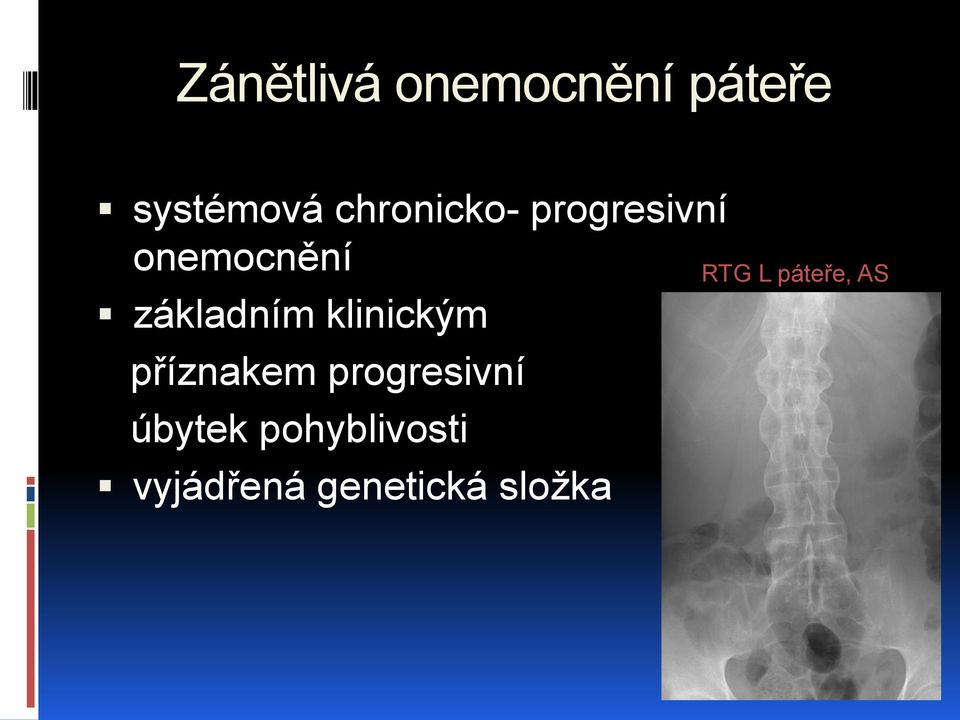 klinickým příznakem progresivní úbytek