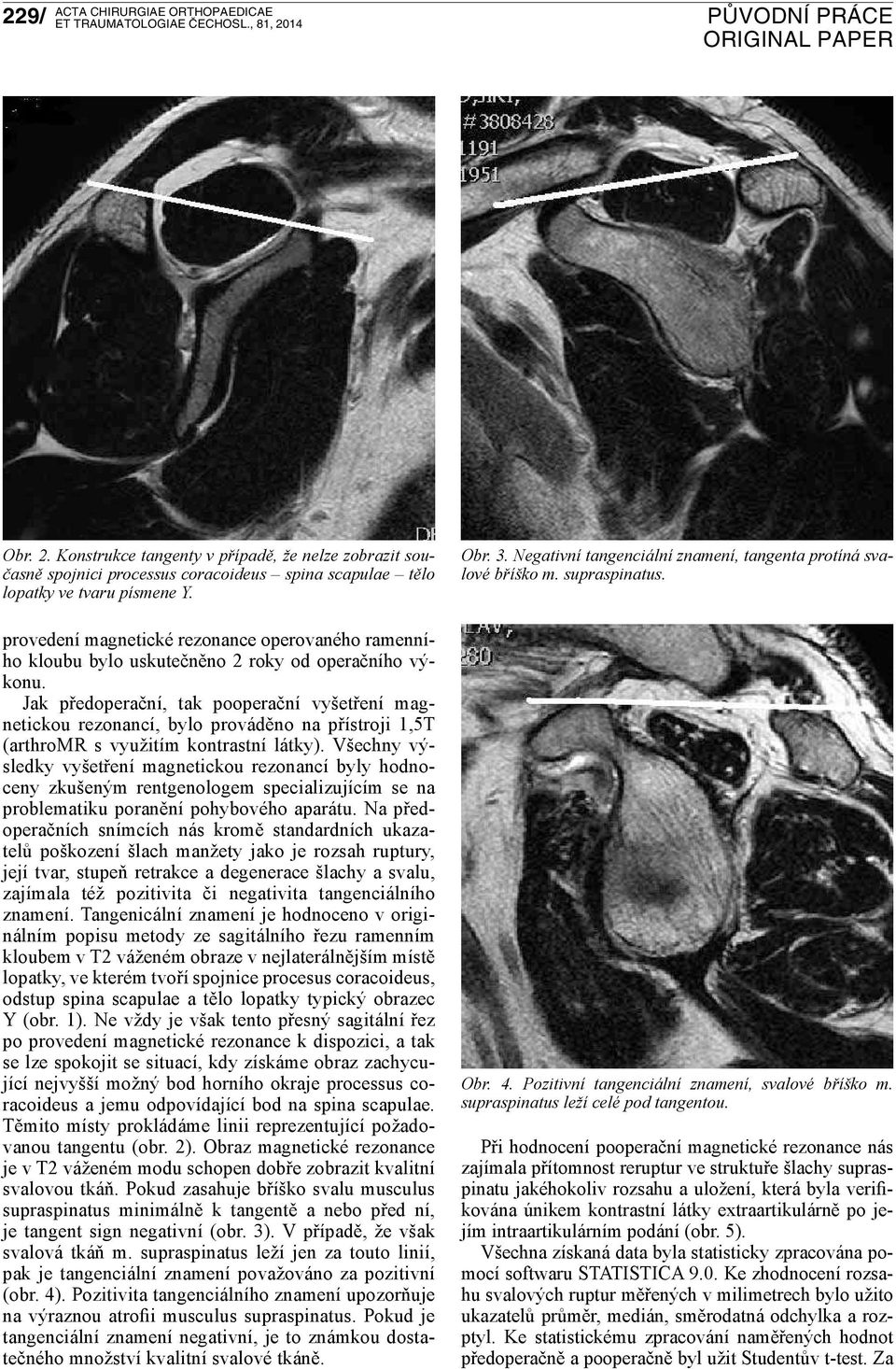 Jak předoperační, tak pooperační vyšetření magnetickou rezonancí, bylo prováděno na přístroji 1,5T (arthromr s využitím kontrastní látky).