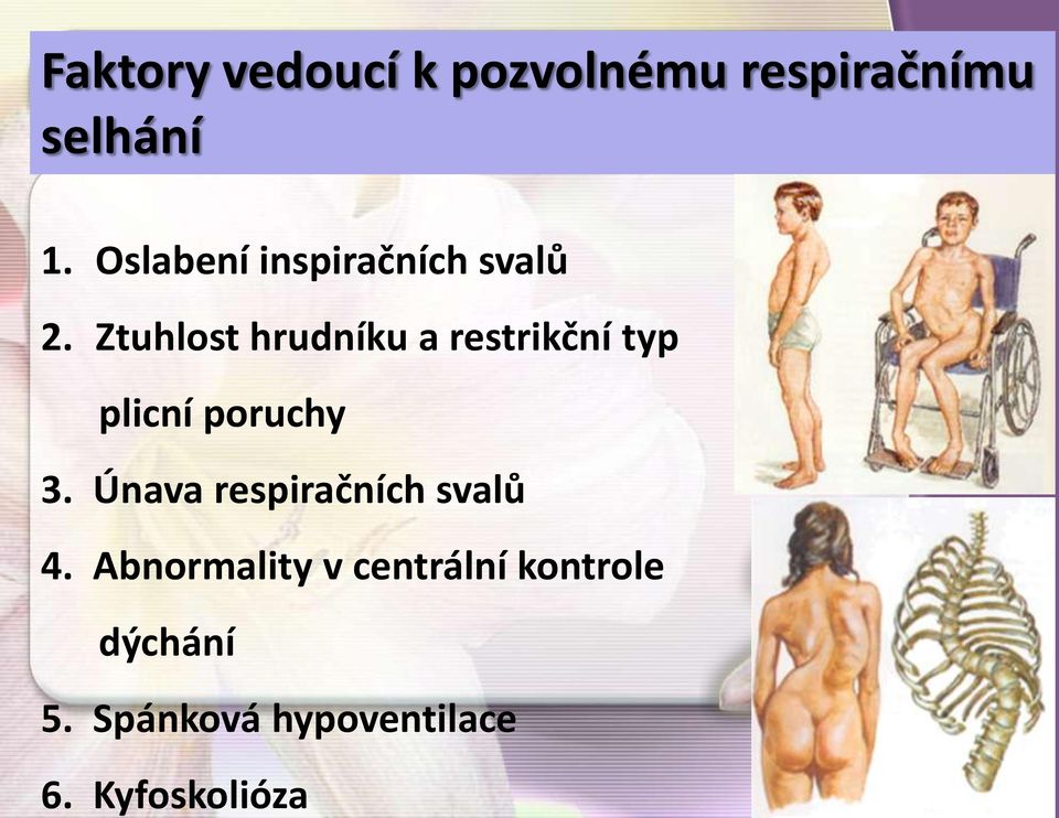 Ztuhlost hrudníku a restrikční typ plicní poruchy 3.