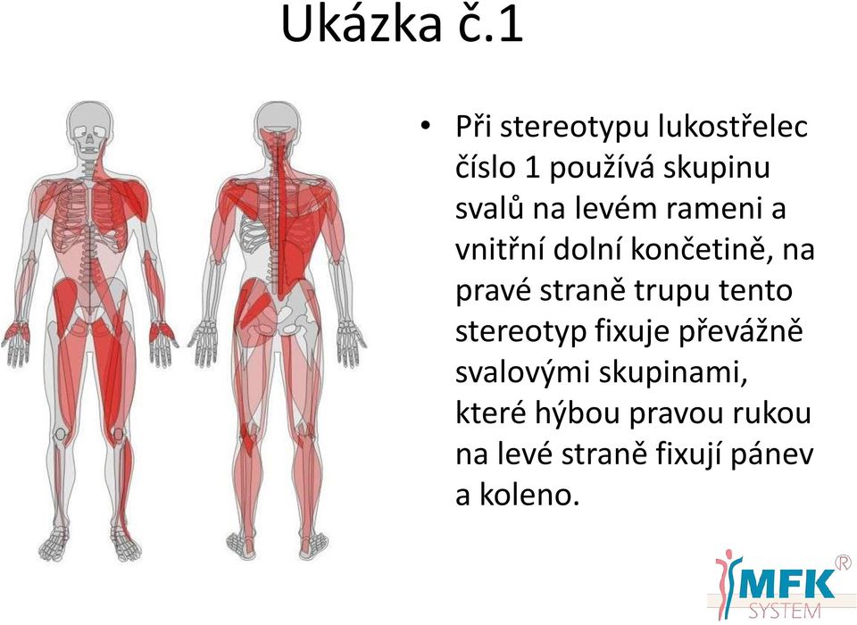 levém rameni a vnitřní dolní končetině, na pravé straně trupu