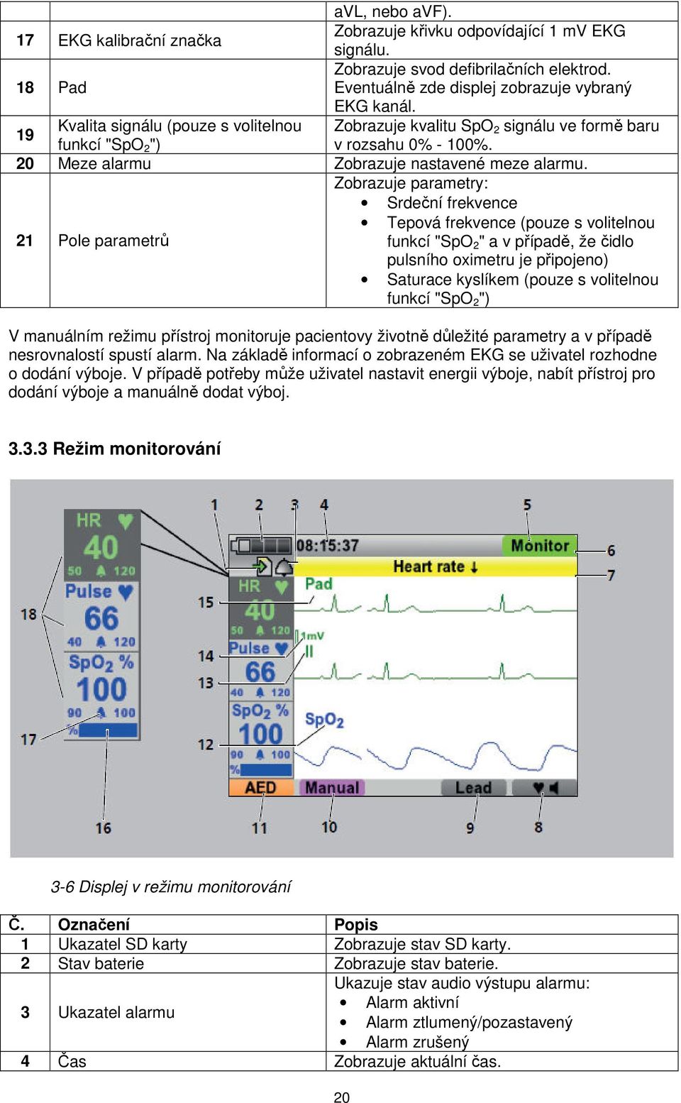 Zobrazuje parametry: Srdeční frekvence Tepová frekvence (pouze s volitelnou 21 Pole parametrů funkcí "SpO 2 " a v případě, že čidlo pulsního oximetru je připojeno) Saturace kyslíkem (pouze s