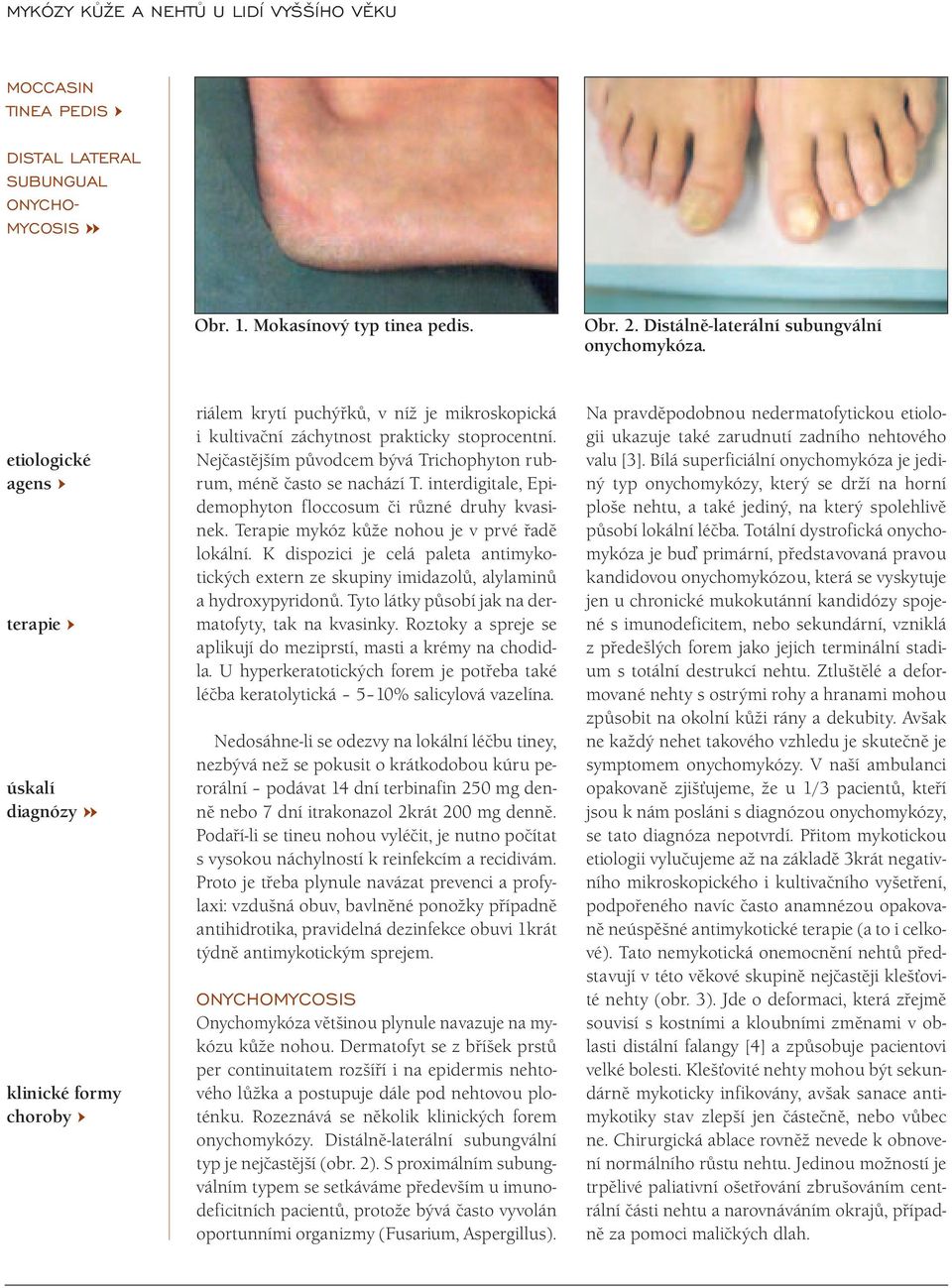 Nejčastějším původcem bývá Trichophyton rubrum, méně často se nachází T. interdigitale, Epidemophyton floccosum či různé druhy kvasinek. Terapie mykóz kůže nohou je v prvé řadě lokální.