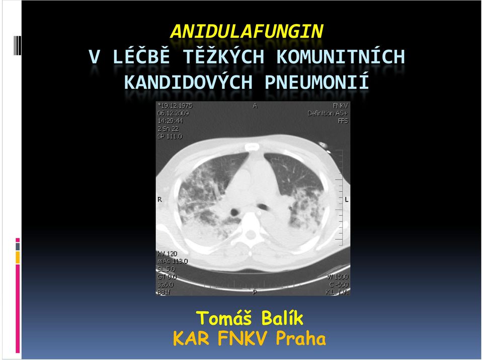 KANDIDOVÝCH PNEUMONIÍ