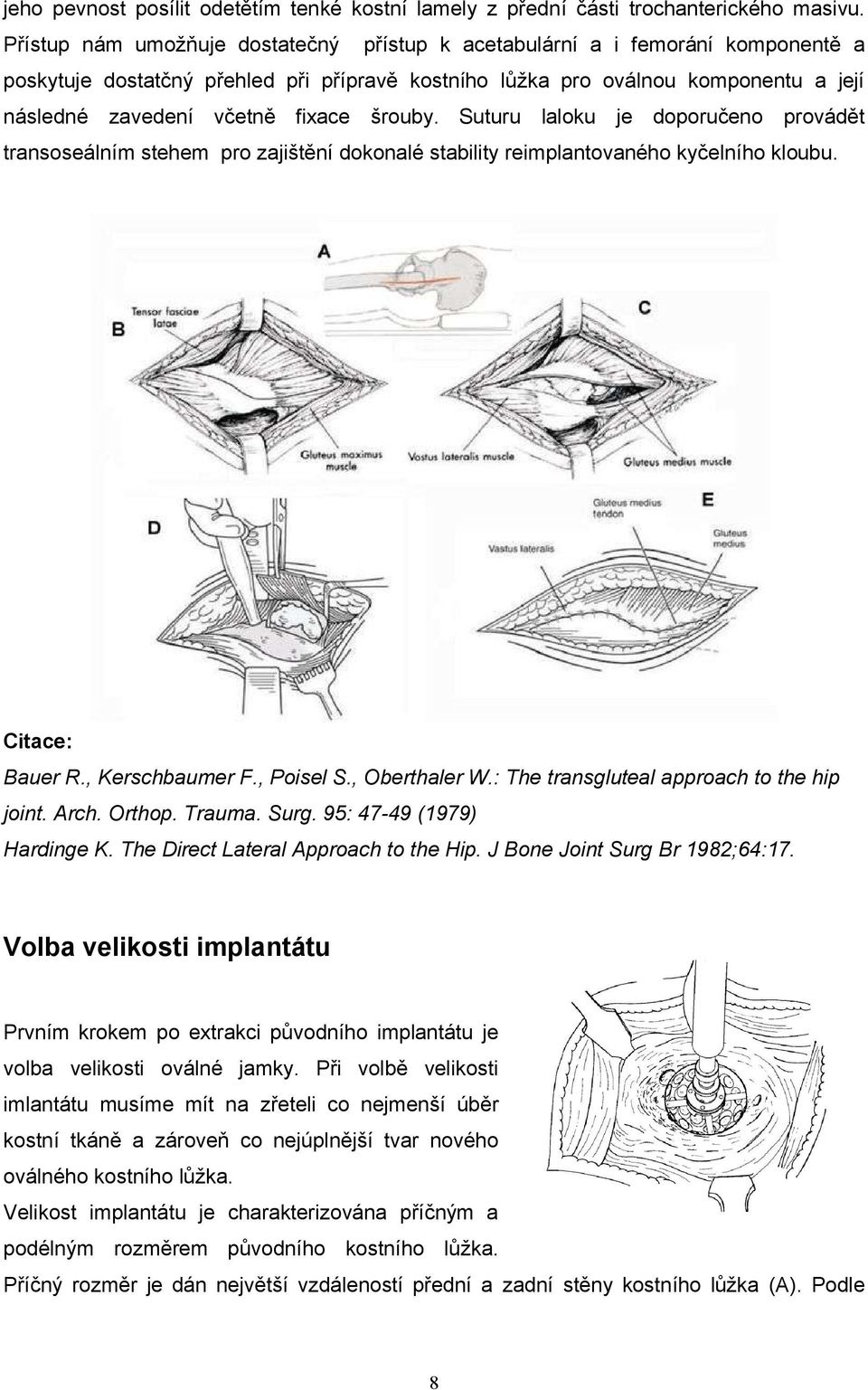 šrouby. Suturu laloku je doporučeno provádět transoseálním stehem pro zajištění dokonalé stability reimplantovaného kyčelního kloubu. Citace: Bauer R., Kerschbaumer F., Poisel S., Oberthaler W.