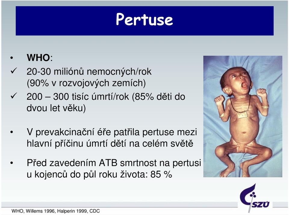 mezi hlavní příčinu úmrtí dětí na celém světě Před zavedením ATB smrtnost na