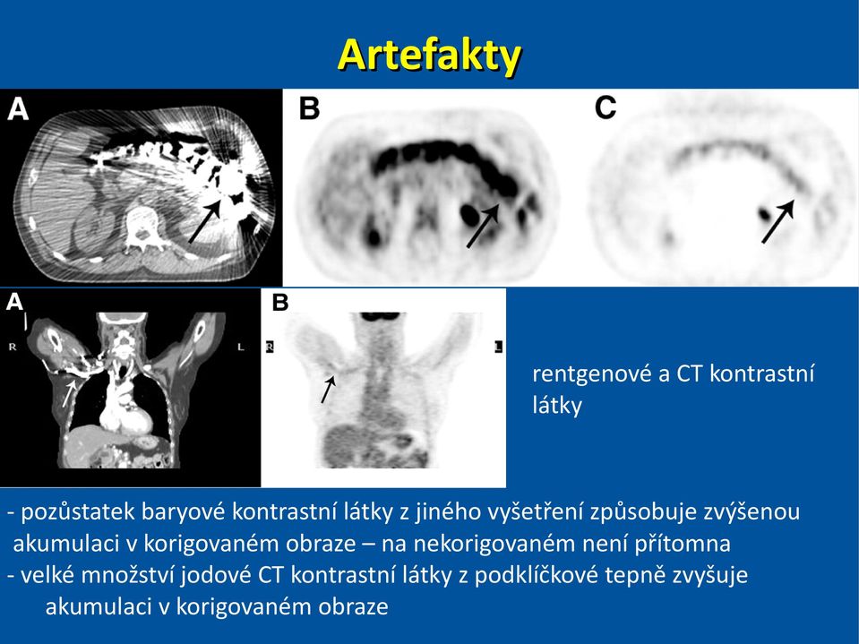 korigovaném obraze na nekorigovaném není přítomna - velké množství