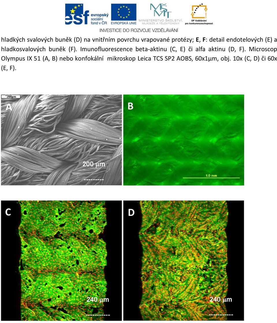 Imunofluorescence beta-aktinu (C, E) či alfa aktinu (D, F).