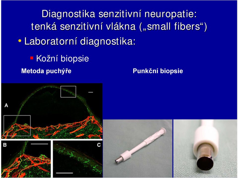 fibers ) Laboratorní diagnostika: