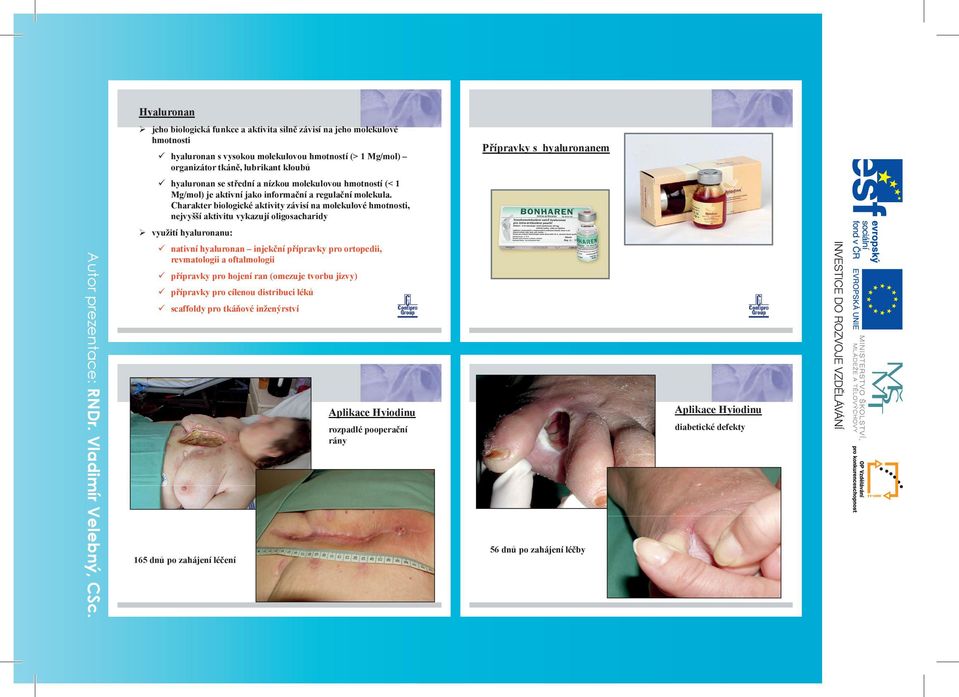 Charakter biologické aktivity závisí na molekulové hmotnosti, nejvyšší aktivitu vykazují oligosacharidy využití hyaluronanu: Autor prezentace: RNDr. Vladimír Velebný, CSc.