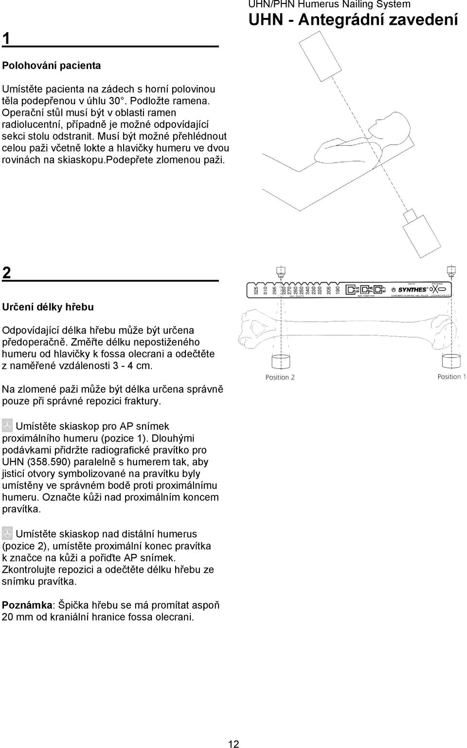 Musí být možné přehlédnout celou paži včetně lokte a hlavičky humeru ve dvou rovinách na skiaskopu.podepřete zlomenou paži. 2 Určení délky hřebu Odpovídající délka hřebu může být určena předoperačně.