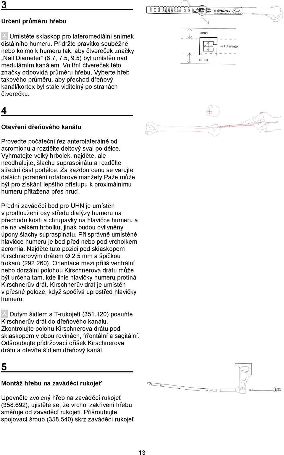 4 Otevření dřeňového kanálu Proveďte počáteční řez anterolaterálně od acromionu a rozdělte deltový sval po délce.