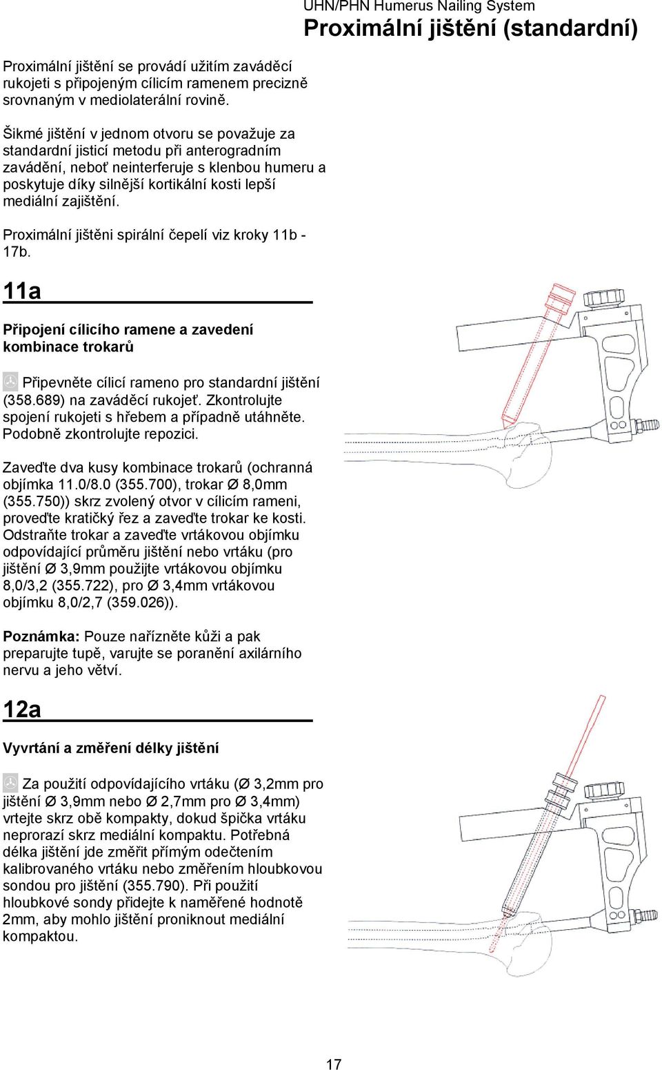 zajištění. Proximální jištěni spirální čepelí viz kroky 11b - 17b. 11a Připojení cílicího ramene a zavedení kombinace trokarů Připevněte cílicí rameno pro standardní jištění (358.