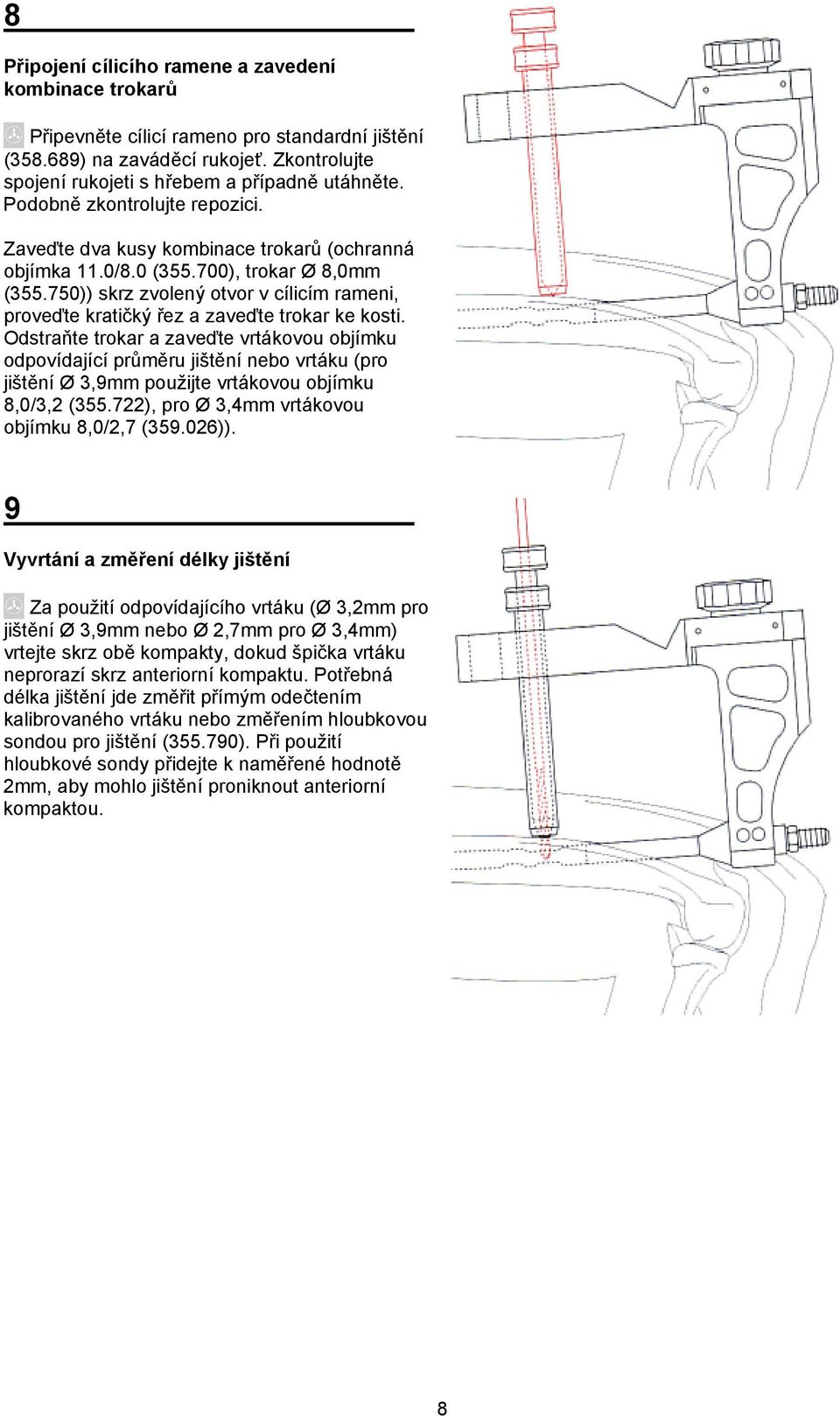 750)) skrz zvolený otvor v cílicím rameni, proveďte kratičký řez a zaveďte trokar ke kosti.