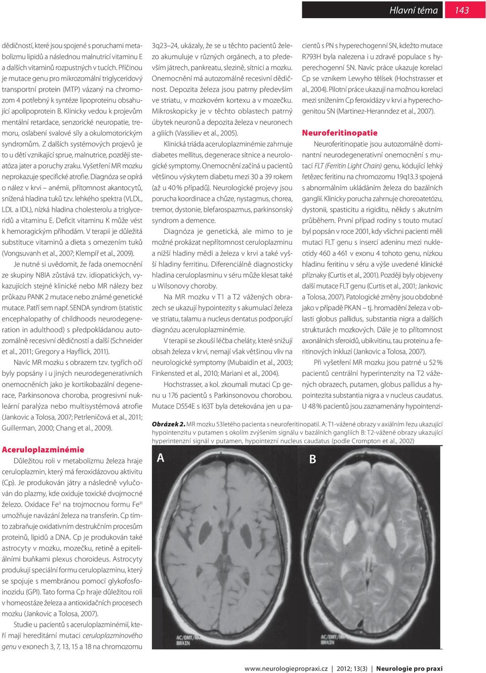 Klinicky vedou k projevům mentální retardace, senzorické neuropatie, tremoru, oslabení svalové síly a okulomotorickým syndromům.