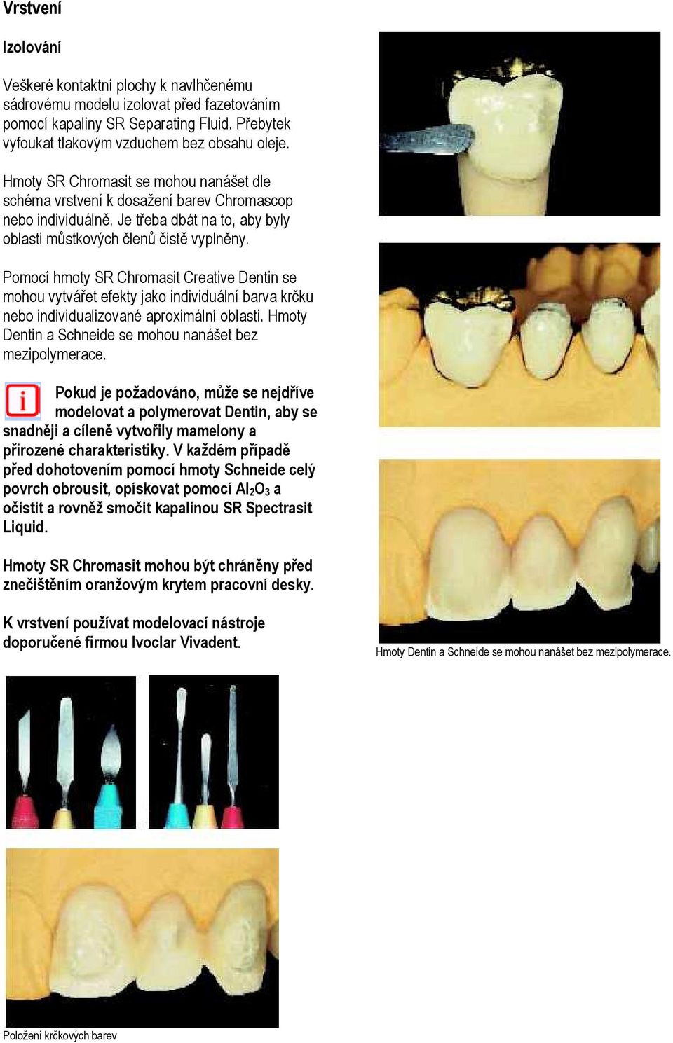 Pomocí hmoty SR Chromasit Creative Dentin se mohou vytvářet efekty jako individuální barva krčku nebo individualizované aproximální oblasti.