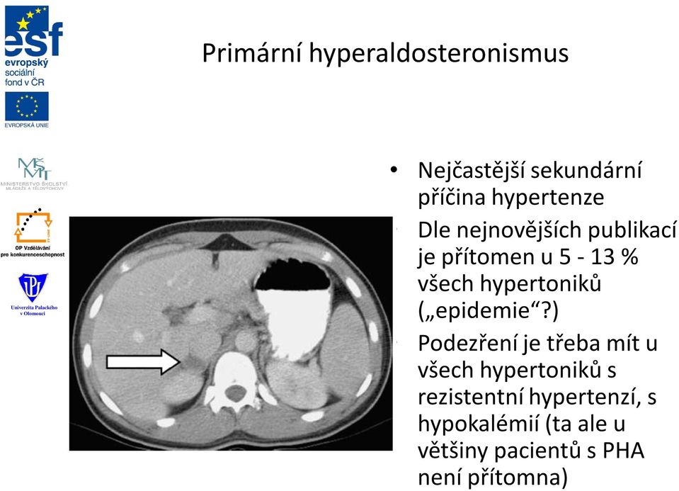 hypertoniků ( epidemie?