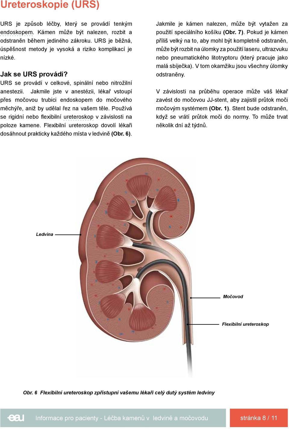 Jakmile jste v anestézii, lékař vstoupí přes močovou trubici endoskopem do močového měchýře, aniž by udělal řez na vašem těle.