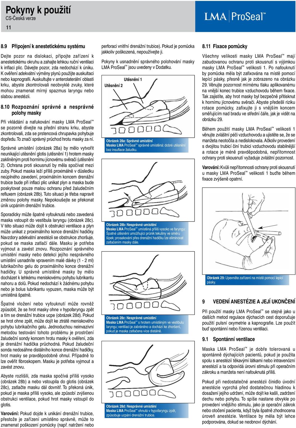 Auskultujte v anterolaterální oblasti krku, abyste zkontrolovali neobvyklé zvuky, které mohou znamenat mírný spazmus laryngu nebo slabou anestézii. 8.