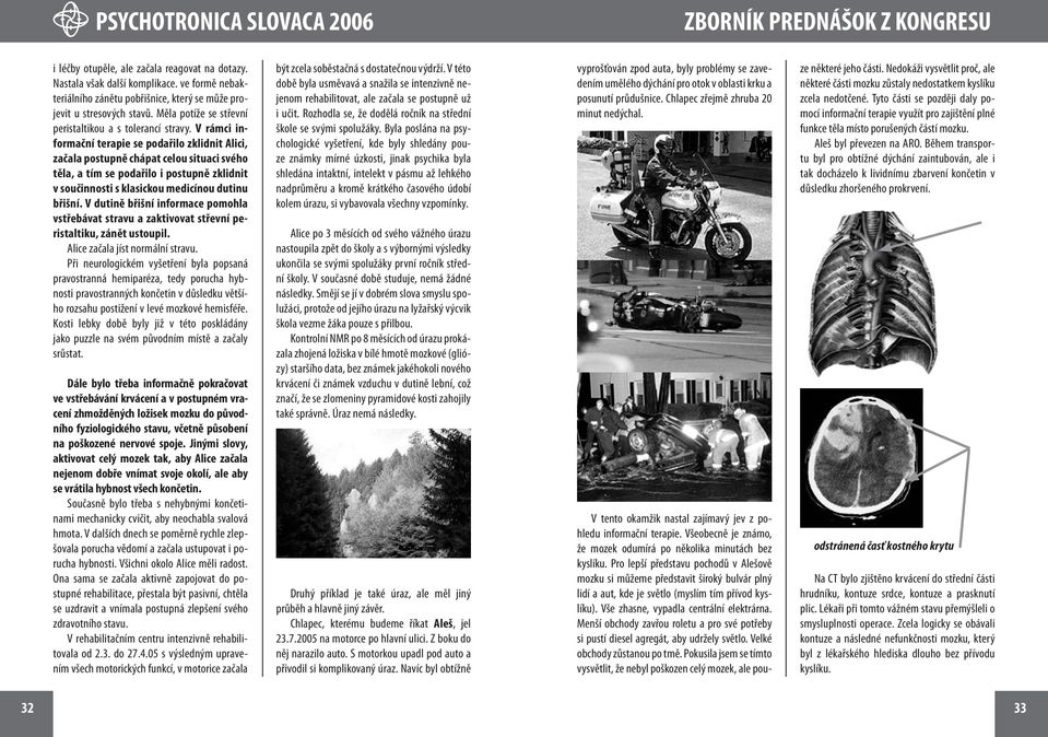 V rámci informační terapie se podařilo zklidnit Alici, začala postupně chápat celou situaci svého těla, a tím se podařilo i postupně zklidnit v součinnosti s klasickou medicínou dutinu břišní.