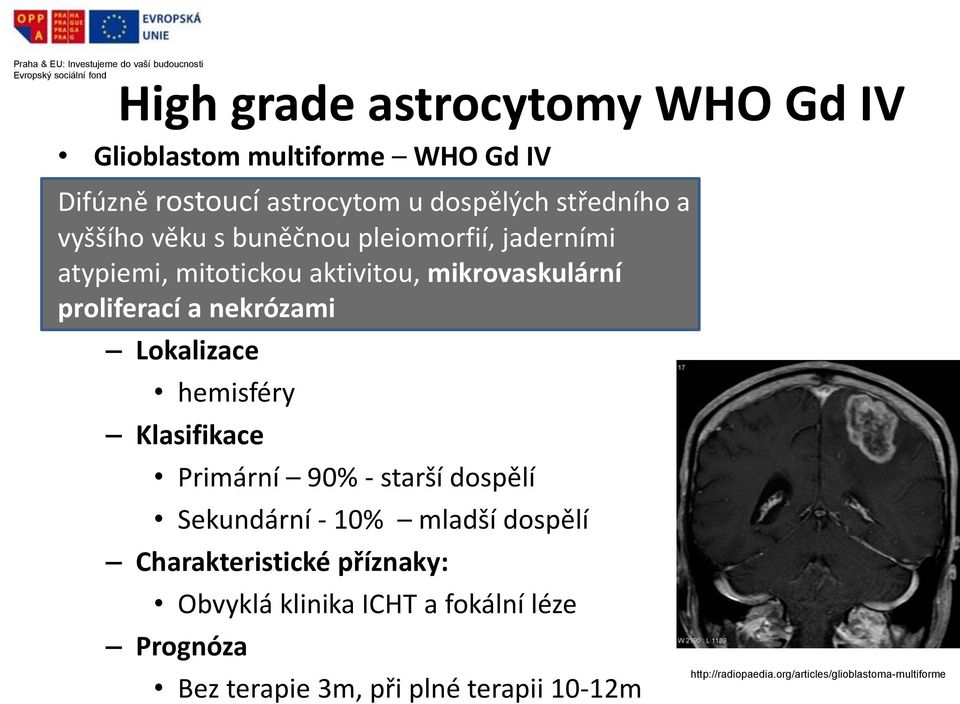 Lokalizace hemisféry Klasifikace Primární 90% - starší dospělí Sekundární - 10% mladší dospělí Charakteristické příznaky: