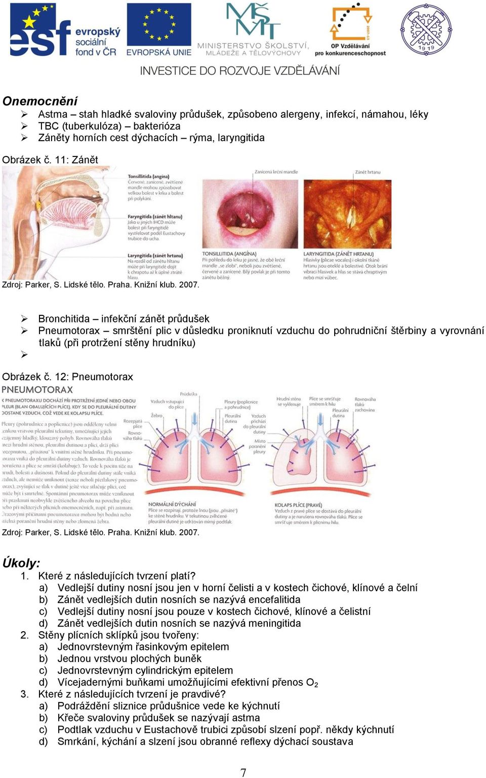 Bronchitida infekční zánět průdušek Pneumotorax smrštění plic v důsledku proniknutí vzduchu do pohrudniční štěrbiny a vyrovnání tlaků (při protržení stěny hrudníku) Obrázek č.