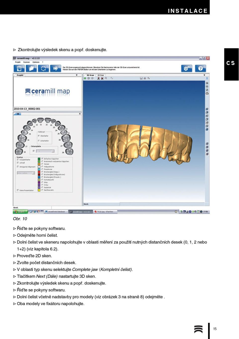 Zvolte počet distančních desek. V oblasti typ skenu selektujte Complete jaw (Kompletní čelist). Tlačítkem Next (Dále) nastartujte 3D sken.