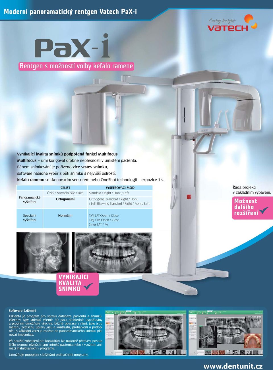 Panoramatické vyšetření Speciální vyšetření ČELIST Úzký / Normální šíře / Dítě Ortogonální Normální VYŠETŘOVACÍ MÓD Standard / Right / Front / Left Orthogonal Standard / Right / Front / Left Bitewing