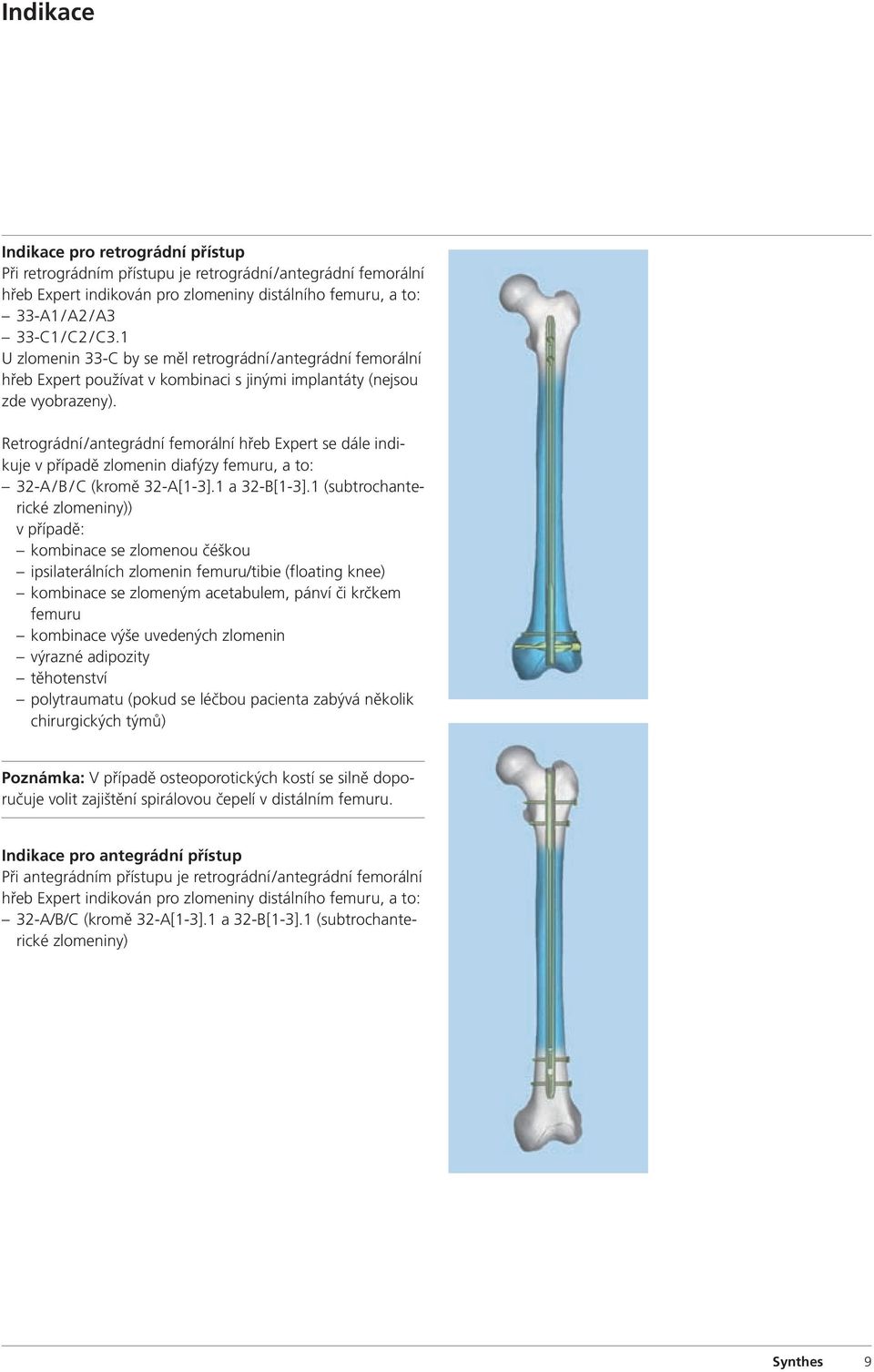 Retrográdní / antegrádní femorální hřeb Expert se dále indikuje v případě zlomenin diafýzy femuru, a to: 32-A / B / C (kromě 32-A[1-3].1 a 32-B[1-3].
