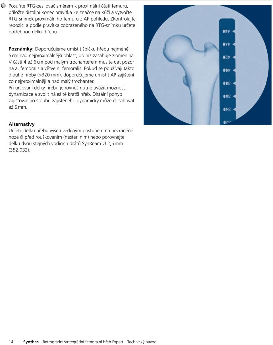 Poznámky: Doporučujeme umístit špičku hřebu nejméně 5 cm nad nejproximálnější oblast, do níž zasahuje zlomenina. V části 4 až 6 cm pod malým trochanterem musíte dát pozor na a. femoralis a větve n.