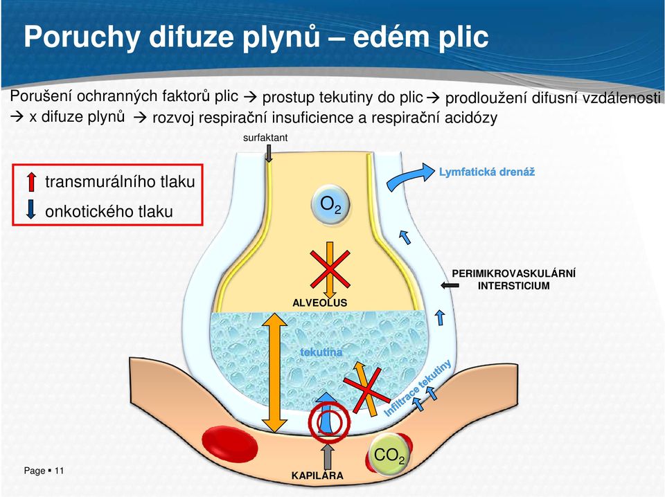 respirační insuficience a respirační acidózy surfaktant transmurálního tlaku