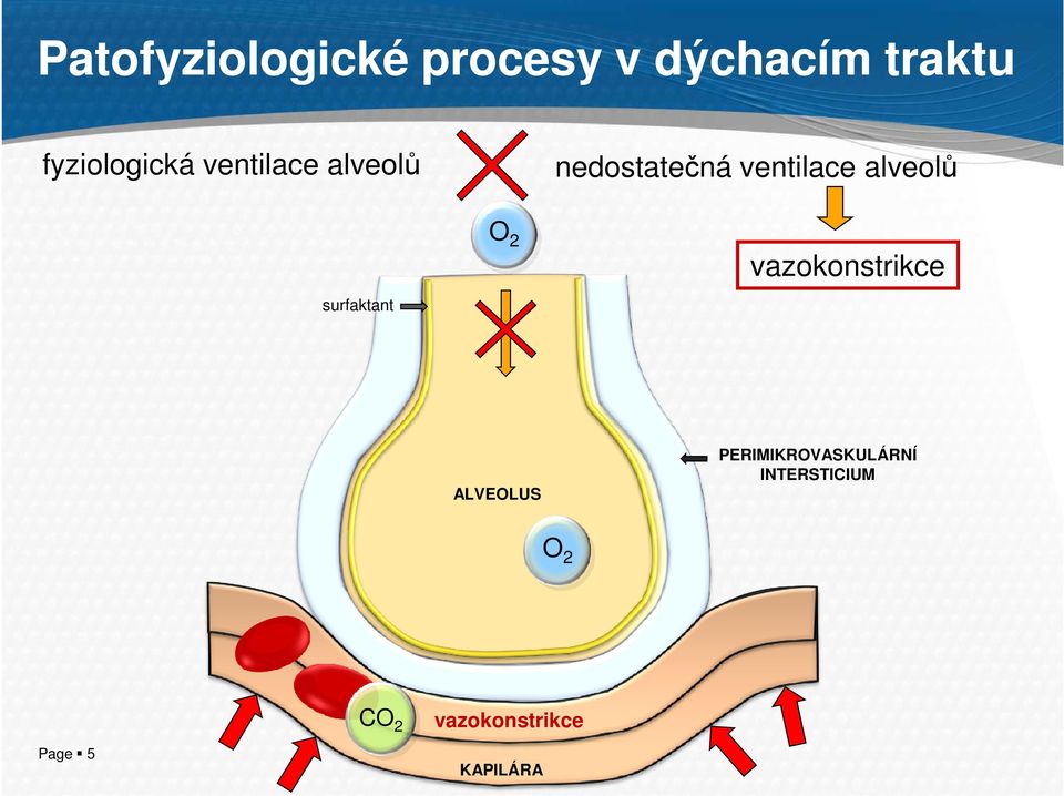 alveolů surfaktant O 2 vazokonstrikce ALVEOLUS