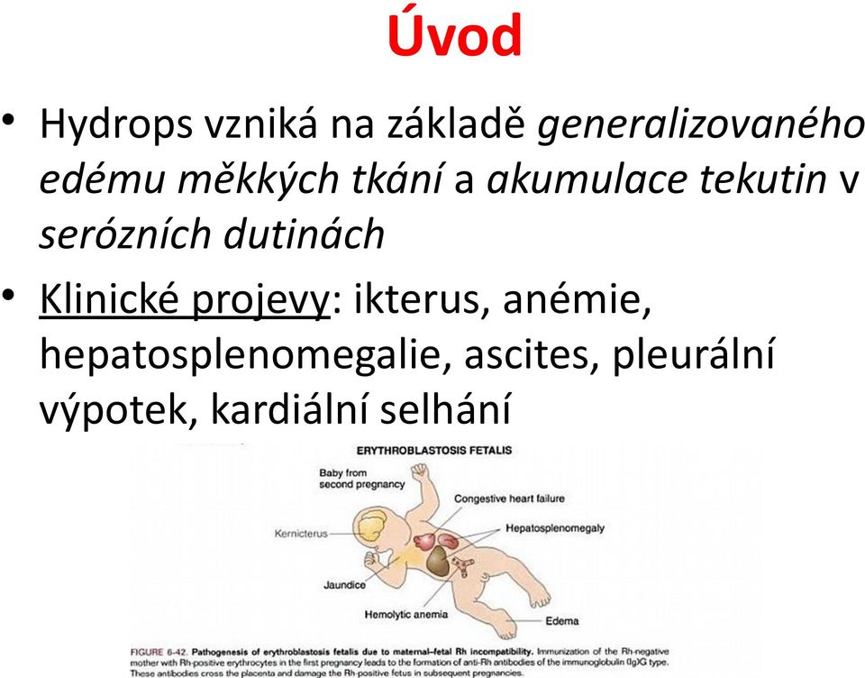 dutinách Klinické projevy: ikterus, anémie,