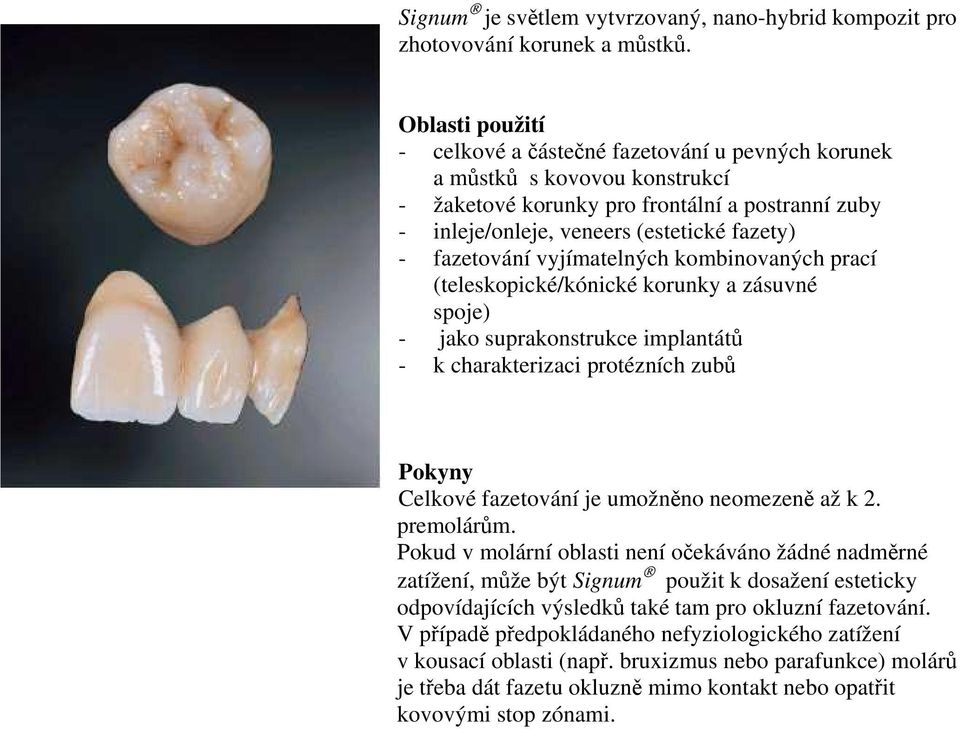 fazetování vyjímatelných kombinovaných prací (teleskopické/kónické korunky a zásuvné spoje) - jako suprakonstrukce implantátů - k charakterizaci protézních zubů Pokyny Celkové fazetování je umožněno