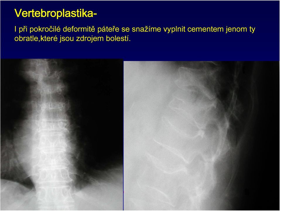 snažíme vyplnit cementem jenom