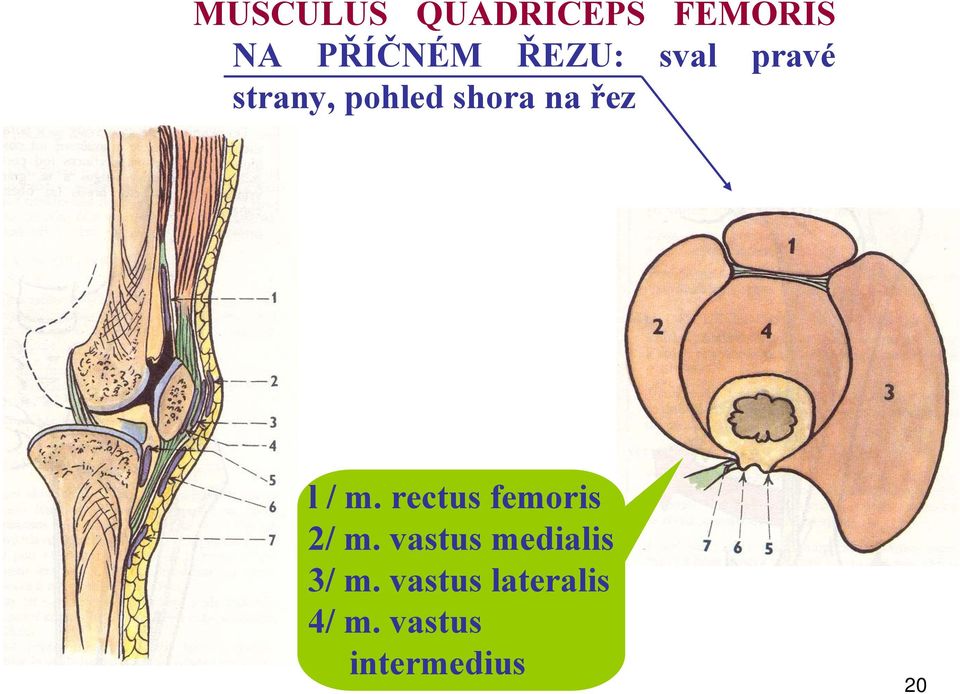 rectus femoris 2/ m. vastus medialis 3/ m.