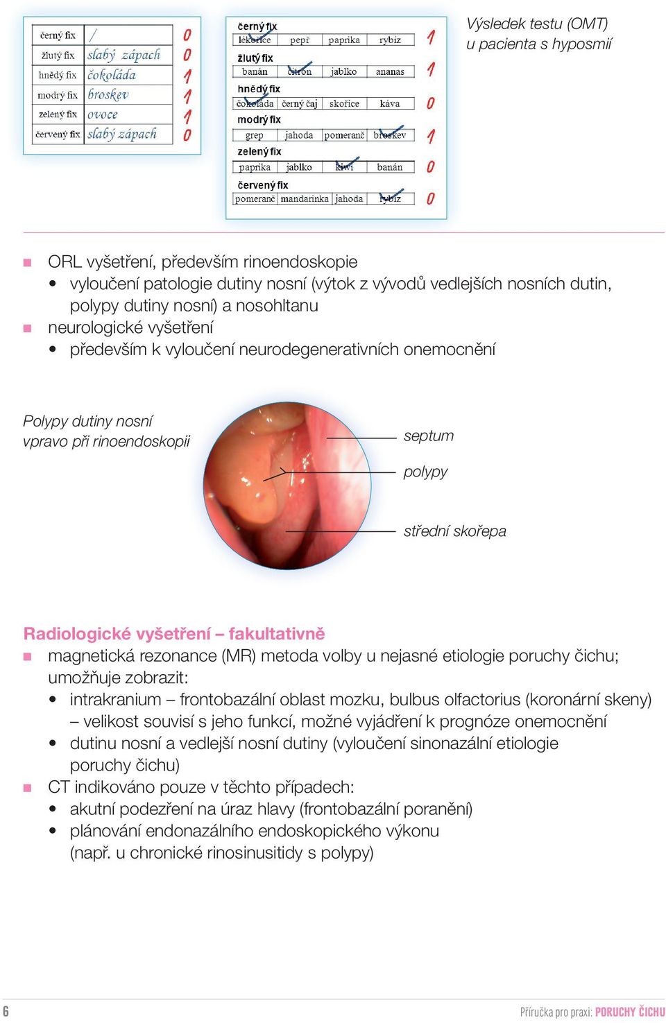 rezonance (MR) metoda volby u nejasné etiologie poruchy čichu; umožňuje zobrazit: intrakranium frontobazální oblast mozku, bulbus olfactorius (koronární skeny) velikost souvisí s jeho funkcí, možné